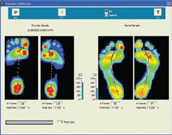 New TOG GaitScan™ in Oundle